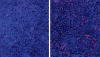 Enlarged area of tumor core, taken from Tim Wang's lab